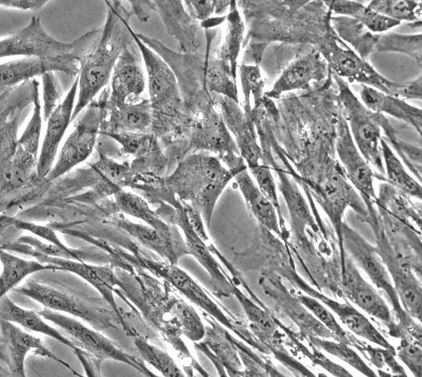 SP2/0小鼠骨髓瘤细胞