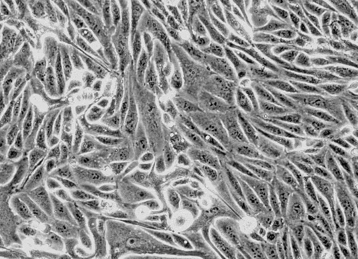 PA317小鼠胚胎成纤维细胞