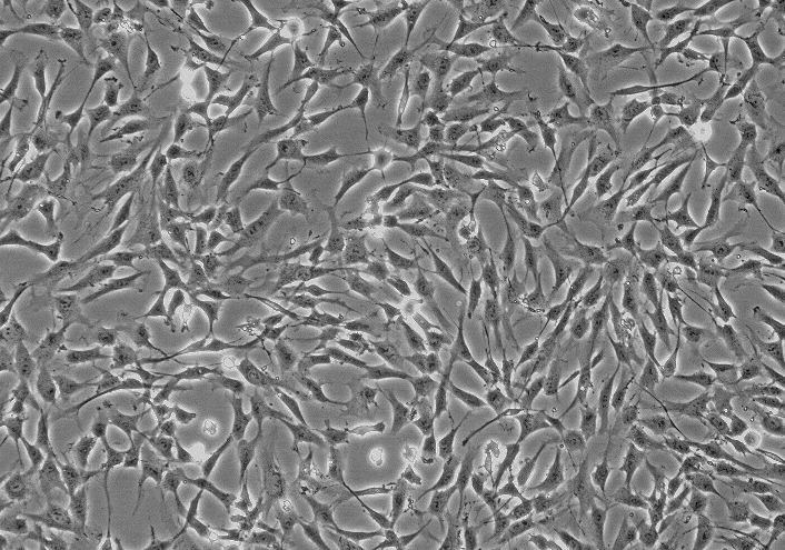 U251神经胶质细胞瘤细胞(通过STR鉴定)