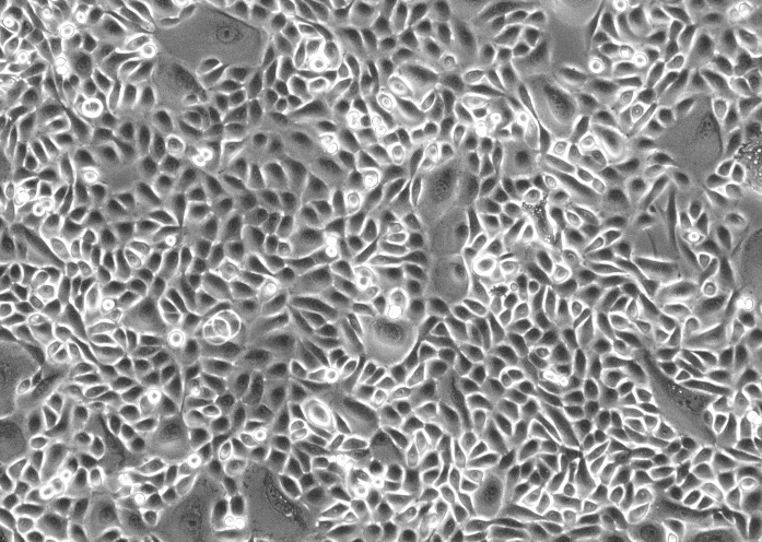 WISH人羊膜细胞(通过STR鉴定)