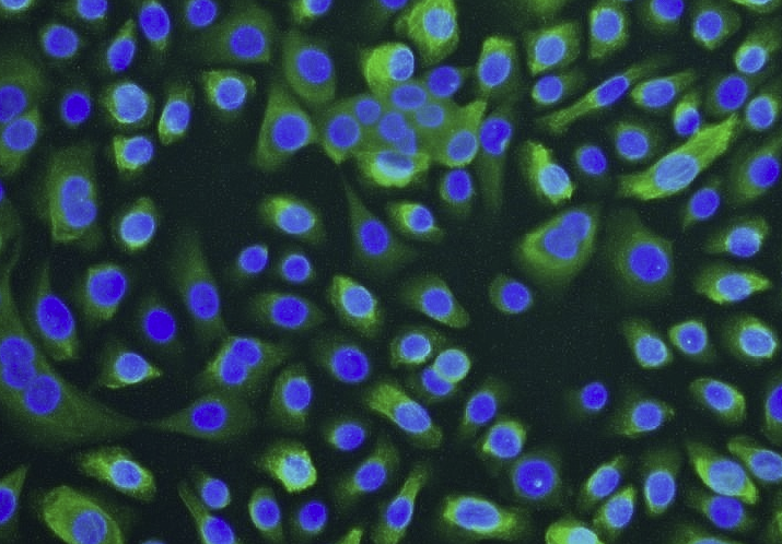 A375人恶性黑色素瘤(通过STR鉴定)