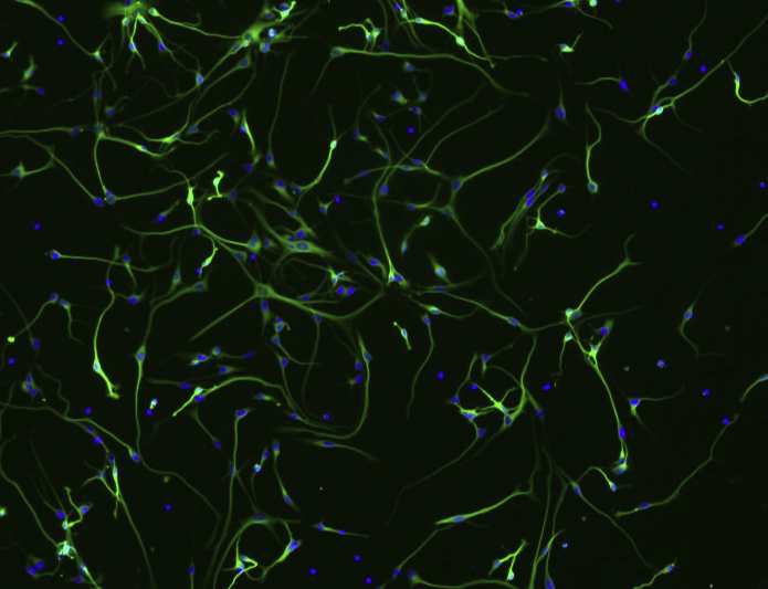 CN人鼻咽癌细胞(通过STR鉴定)