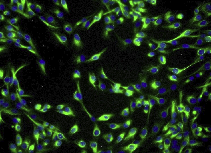 MA-782小鼠乳腺癌细胞