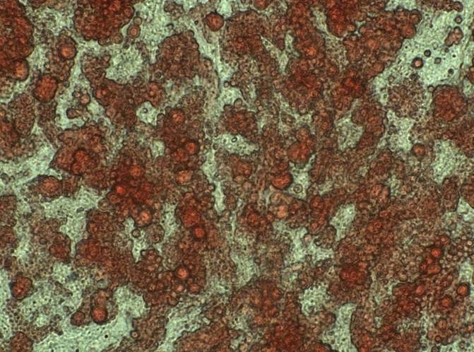 HepG2人肝细胞癌(通过STR鉴定)