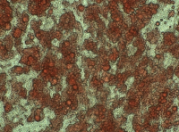 HepG2人肝细胞癌(通过STR鉴定)