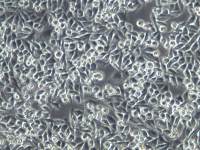 SW1116人结肠癌细胞;SW1116、SW1116细胞