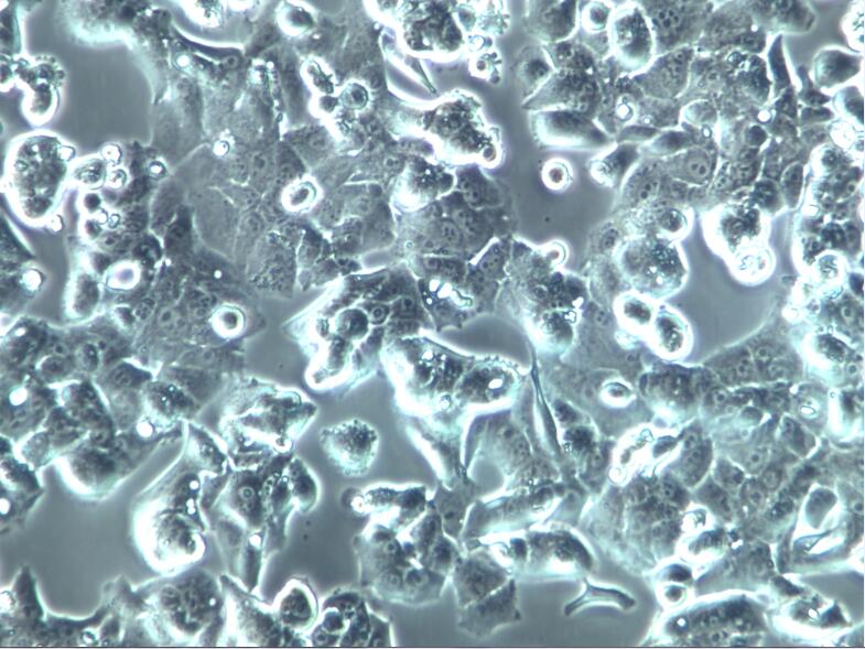MC3T3-E1小鼠胚胎成骨细胞前体细胞；MC3T3-E1
