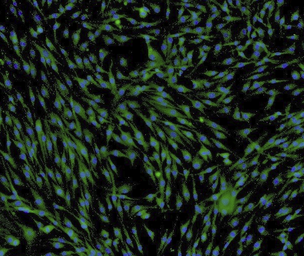 MCF-7人乳腺癌细胞系(通过STR鉴定)