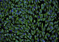 MCF-7人乳腺腺癌细胞(通过STR鉴定)
