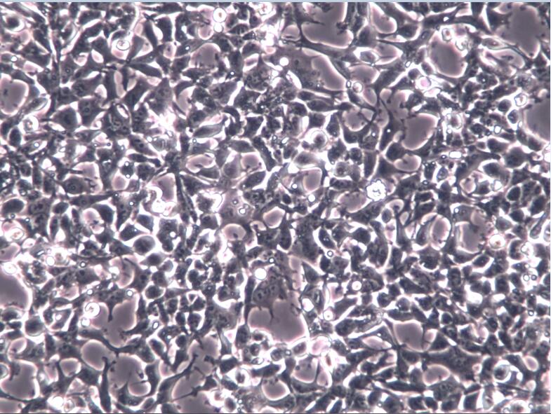 NB4、急性早幼粒细胞株；NB4、NB4细胞
