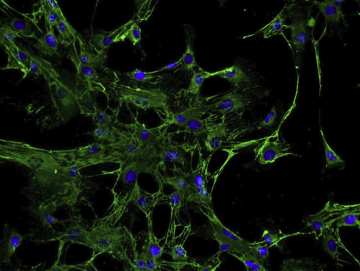 LoVo人结肠腺癌细胞(通过STR鉴定)