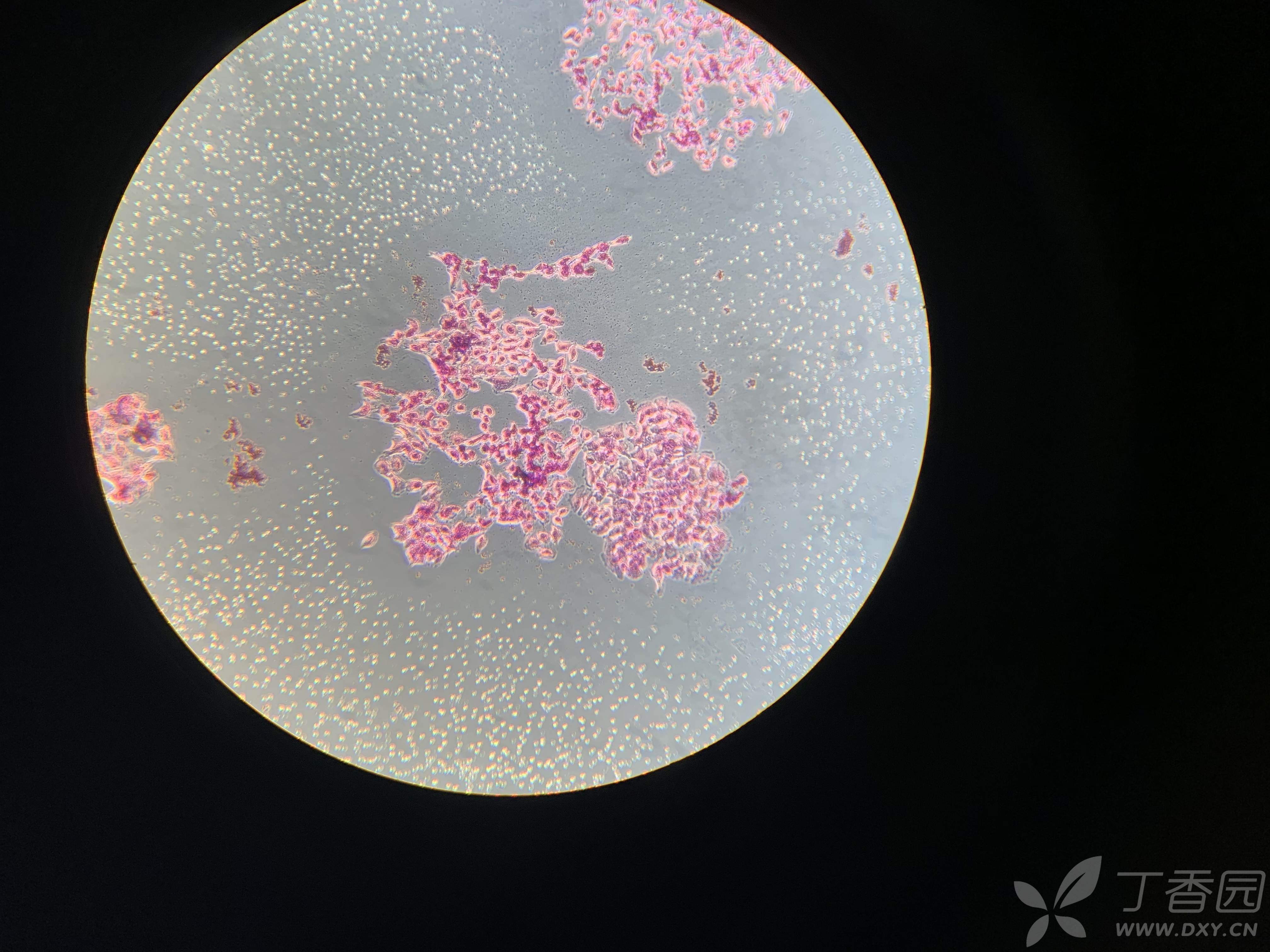 关于平板克隆形成实验