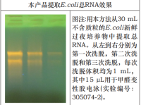大提柱式细菌RNAOUT