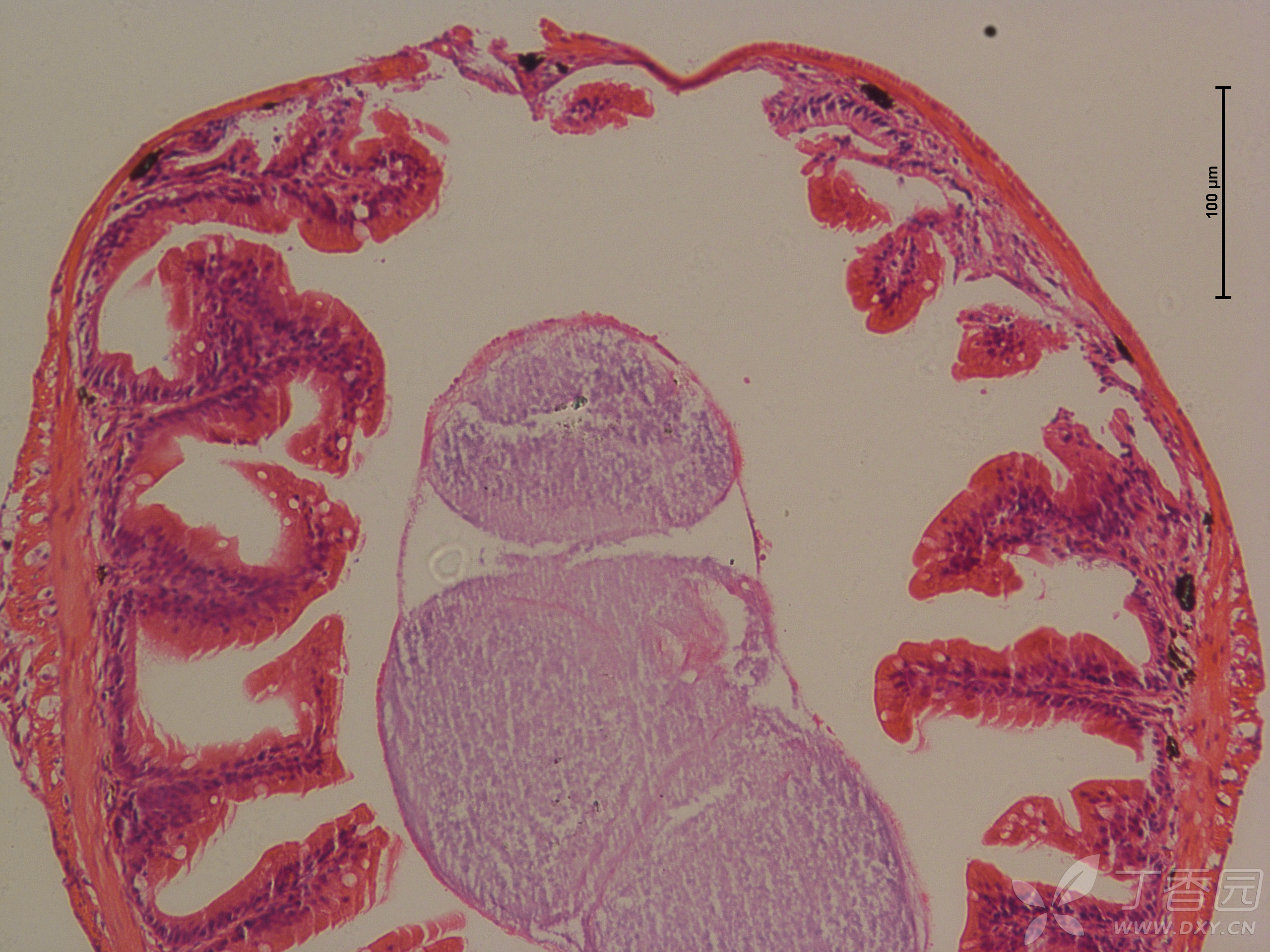 鱼类肠道he切片,求大佬指点 - 临床病理讨论会 -丁香园论坛