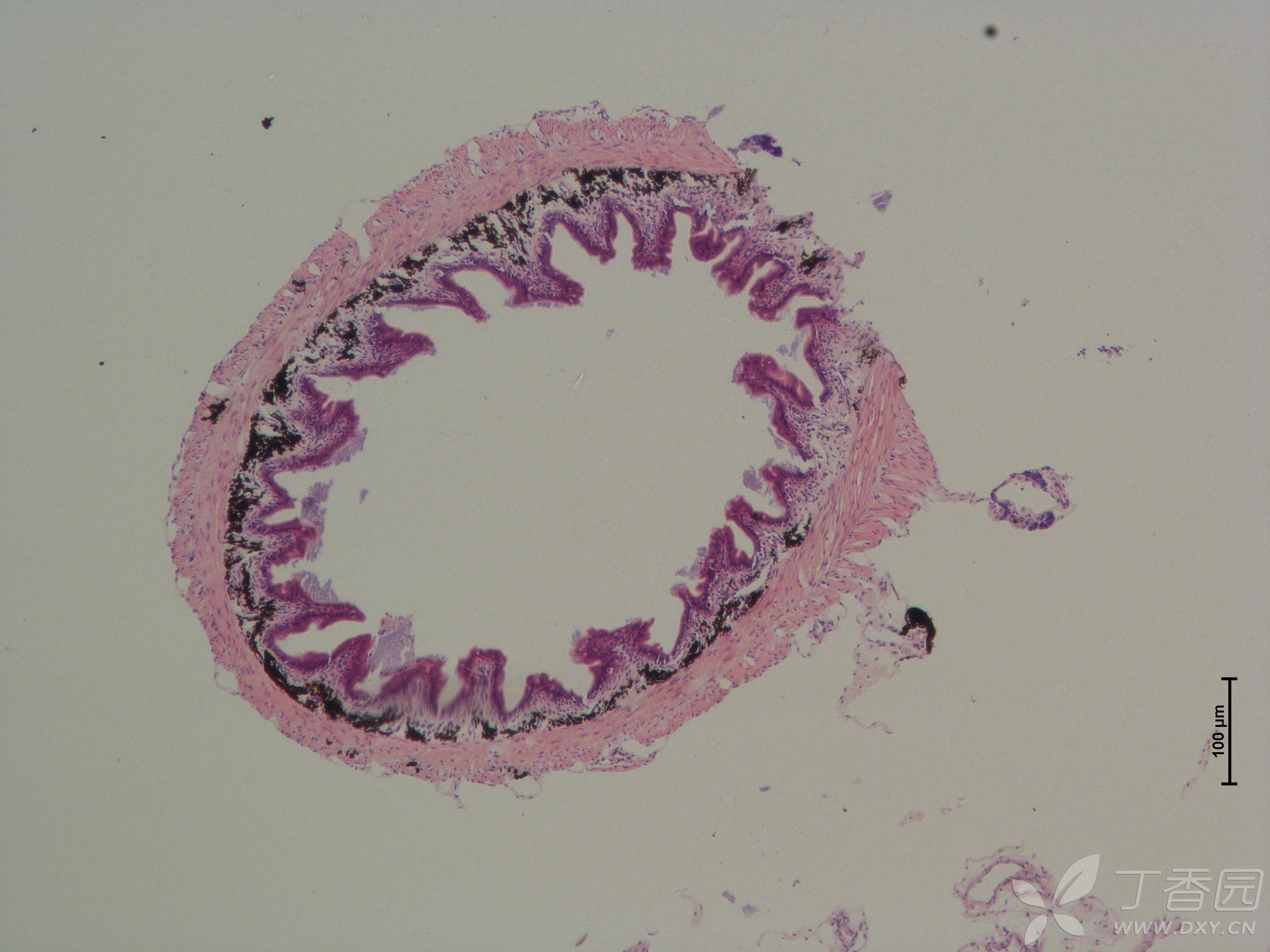 鱼类肠道he切片,求大佬指点