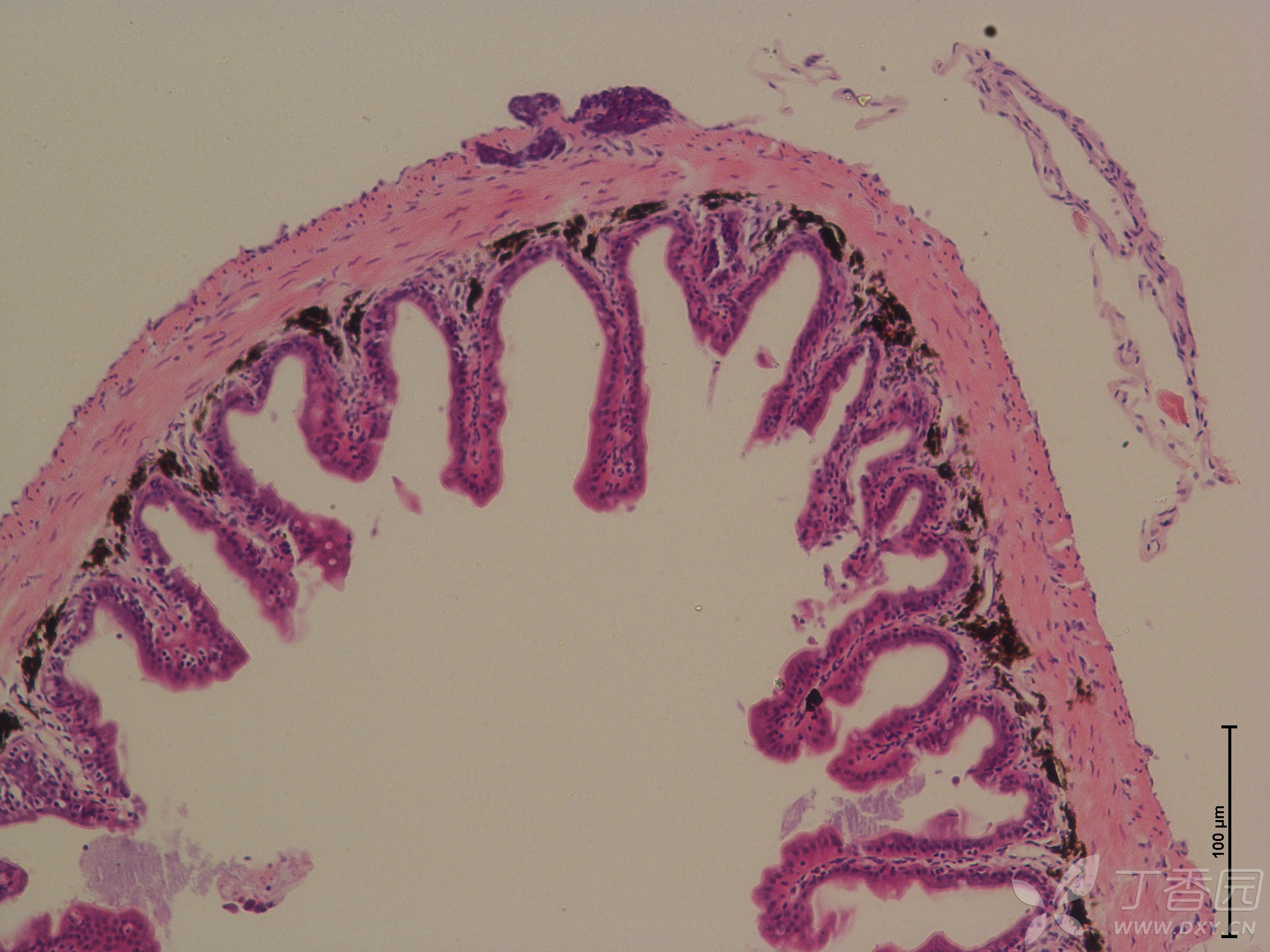 图13- 7号样品,处理后期,预计出现炎症和绒毛萎缩-前肠-染色较淡-20x