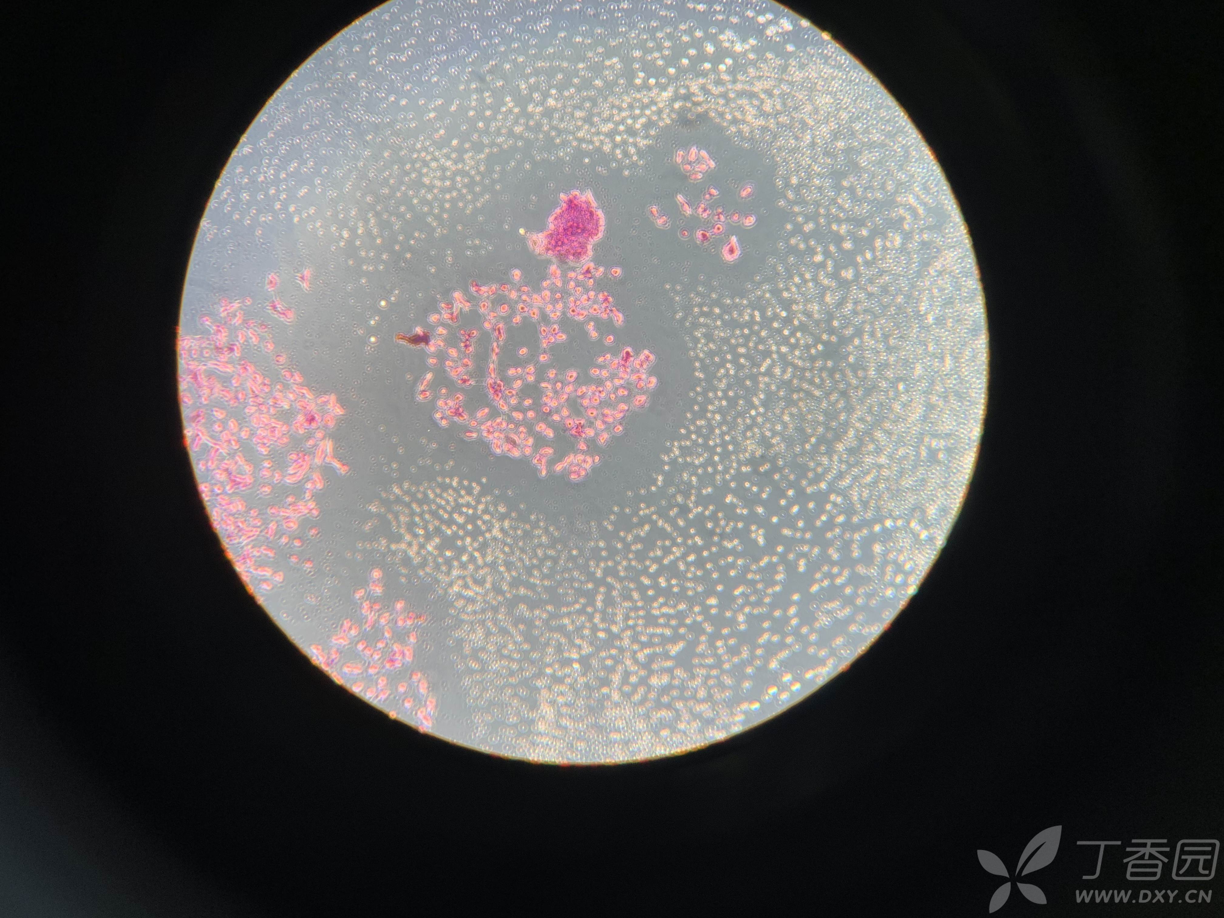 关于平板克隆形成实验