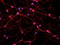 原代细胞培养（鉴定）