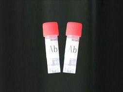 Anti-Celldeathinducingprotein/C16orf5抗體