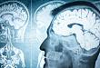 脑内 β-淀粉样蛋白沉积与焦虑和抑郁症状的发生相关