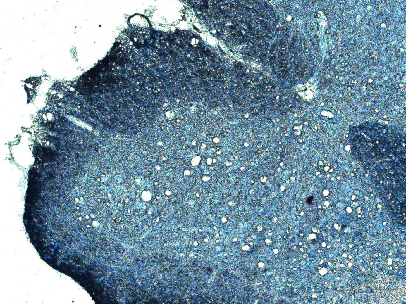 哪位大神知道这是脊髓什么染色吗?目的是什么?谢谢