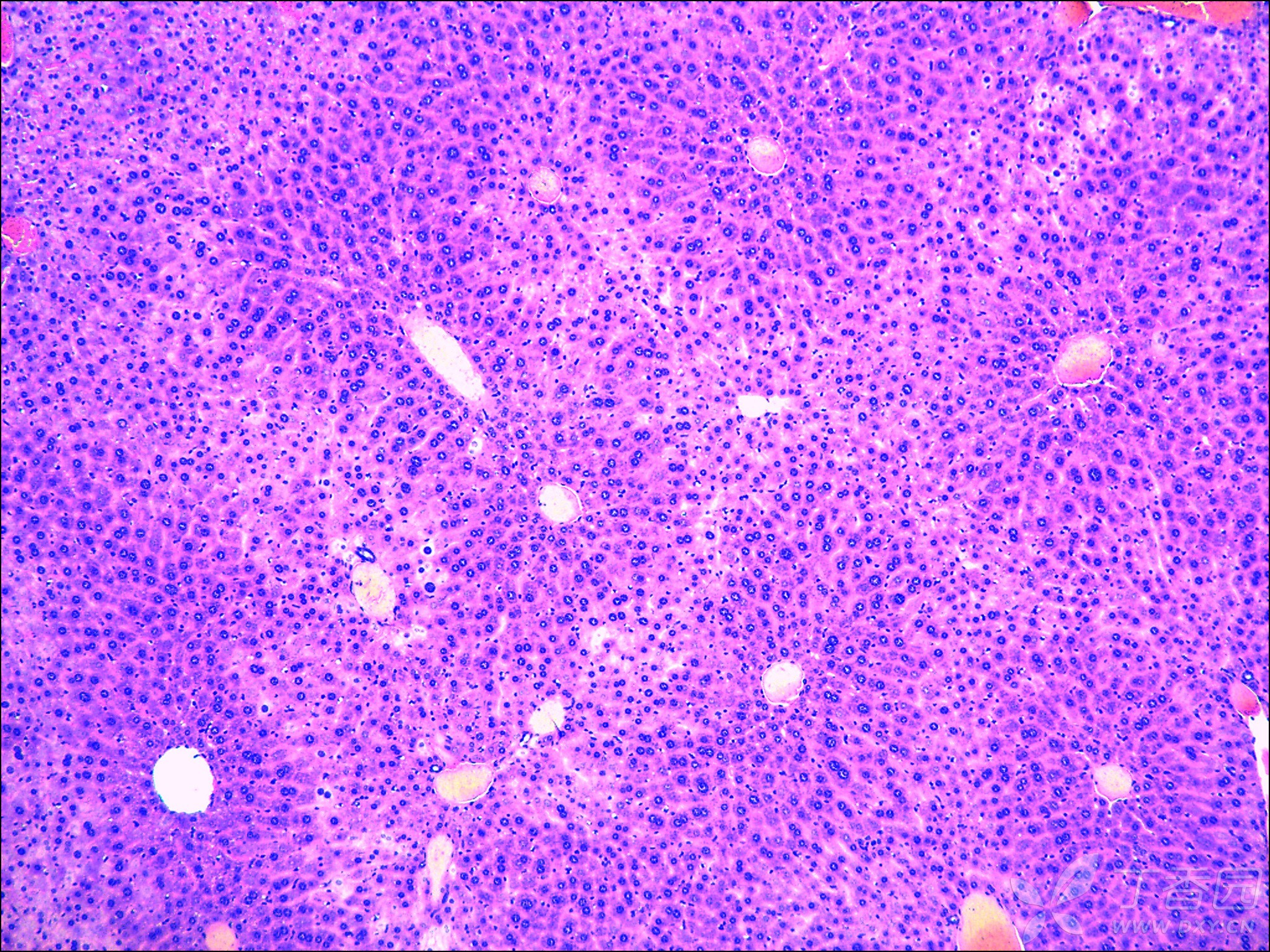 肝细胞电镜图图片