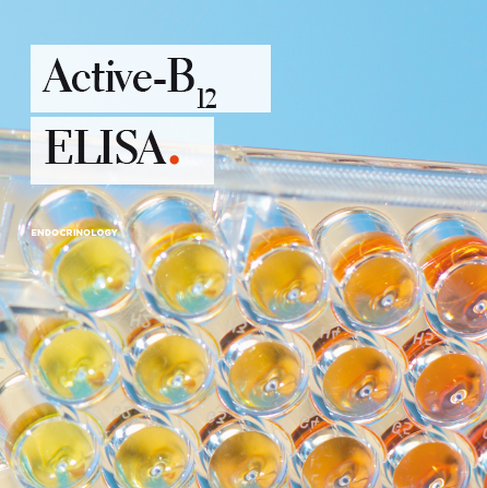 活性维生素B12 ELISA检测