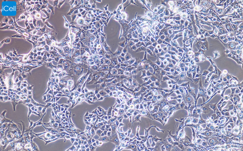 RD 人恶性胚胎横纹肌肉瘤细胞/STR鉴定/镜像绮点（Cellverse）