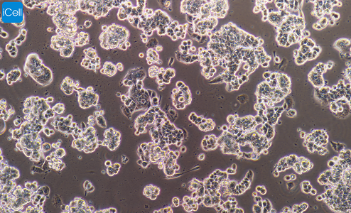 MCF-7人乳腺癌细胞/STR鉴定/镜像绮点（Cellverse）