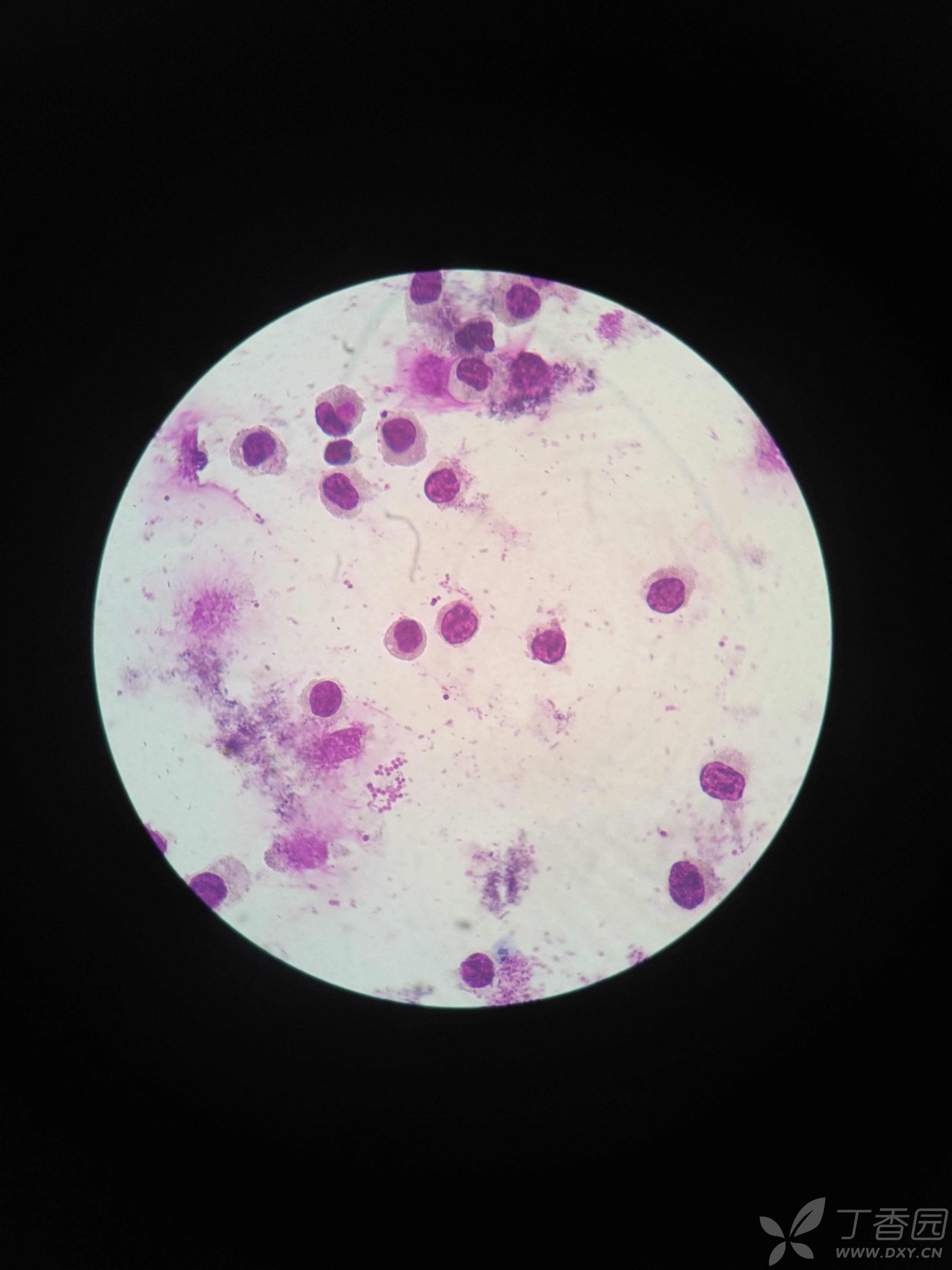 豚鼠肺泡灌洗 白细胞分类计数 瑞氏染色 - 丁香园论坛