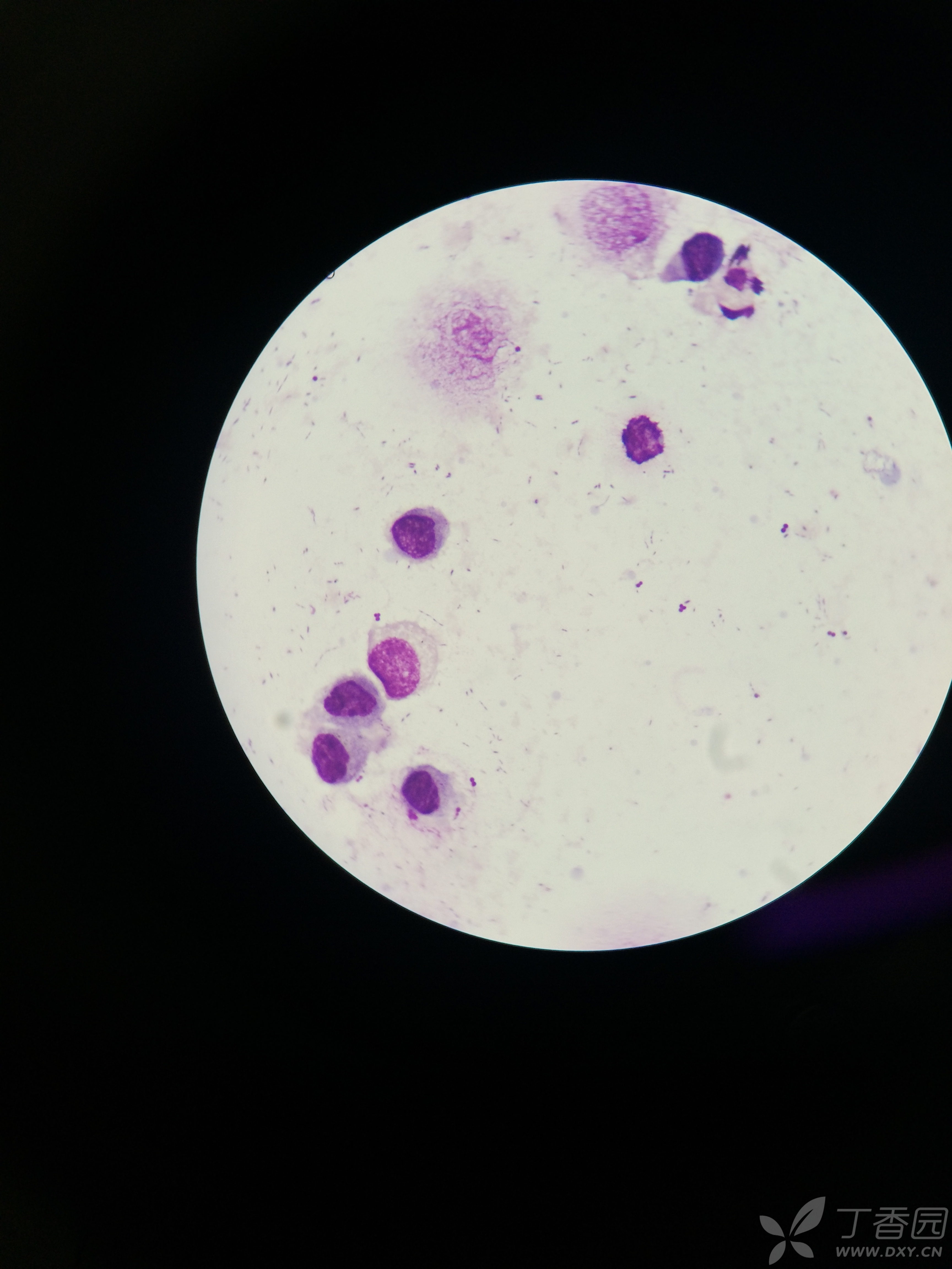 豚鼠肺泡灌洗 白细胞分类计数 瑞氏染色