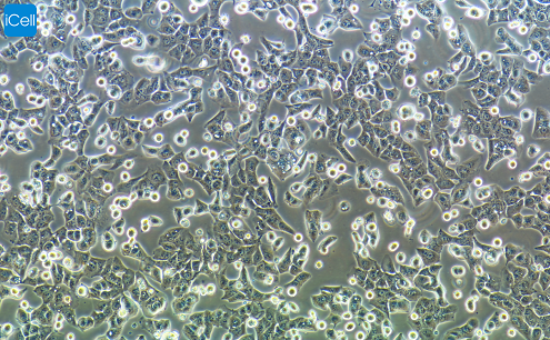 MHCC-97H 人高转移性肝癌细胞/STR鉴定/镜像绮点（Cellverse）