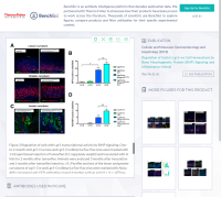 Invitrogen Ki-67 Monoclonal Antibody (SP6)