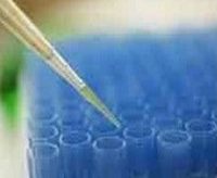 Anti-phospho-TSFP1/SP1(Thr453)价格