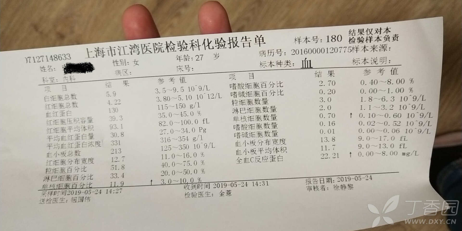 医院视力检查怎么检查 3347300689377928920-8w.jpg