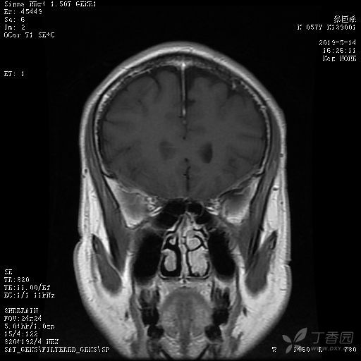 3347288964116965573-8w.jpg