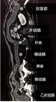 3347243347269470100-8w.png