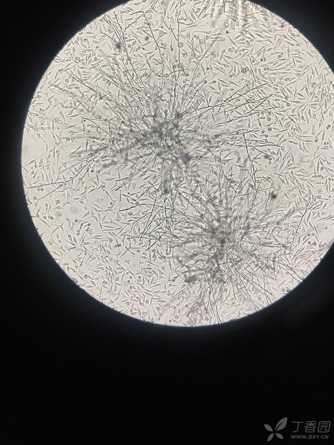 培养的是sh-sy5y细胞,本来用的是dmem 10�s 1%ps,2月份开始发现污染