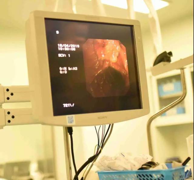 「镜」厉害的！40 分钟成功实施 ERCP 手术