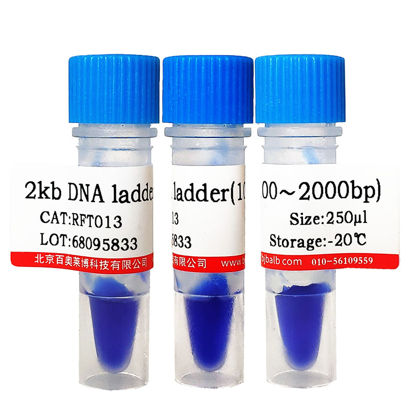 T4 RNA 连接酶 1（ssRNA 连接酶） 高浓度