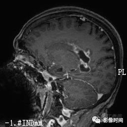 3348177665864764819-8w.jpg