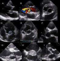 小动物高分辨率超声影像