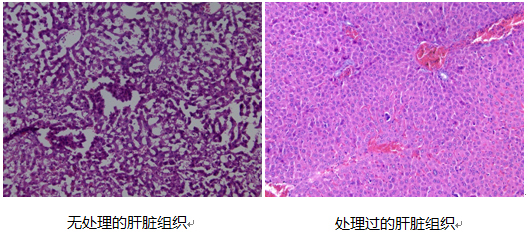 結果展示一般方法做的冰凍切片有如下的空泡(冰晶形成的結果)表2不同