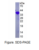 含YjeF氨基端域蛋白3(YJEFN3)重组蛋白