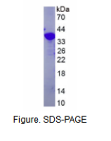 含YjeF氨基端域蛋白3(YJEFN3)重组蛋白