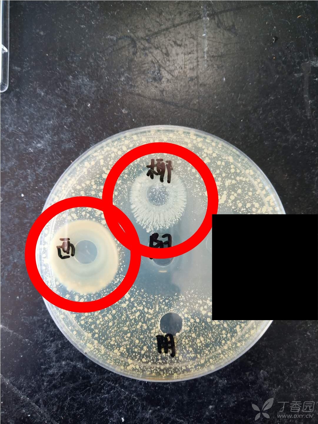 大肠杆菌抑菌圈图片
