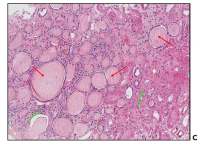 LC3B抗体(兔多抗)厂家