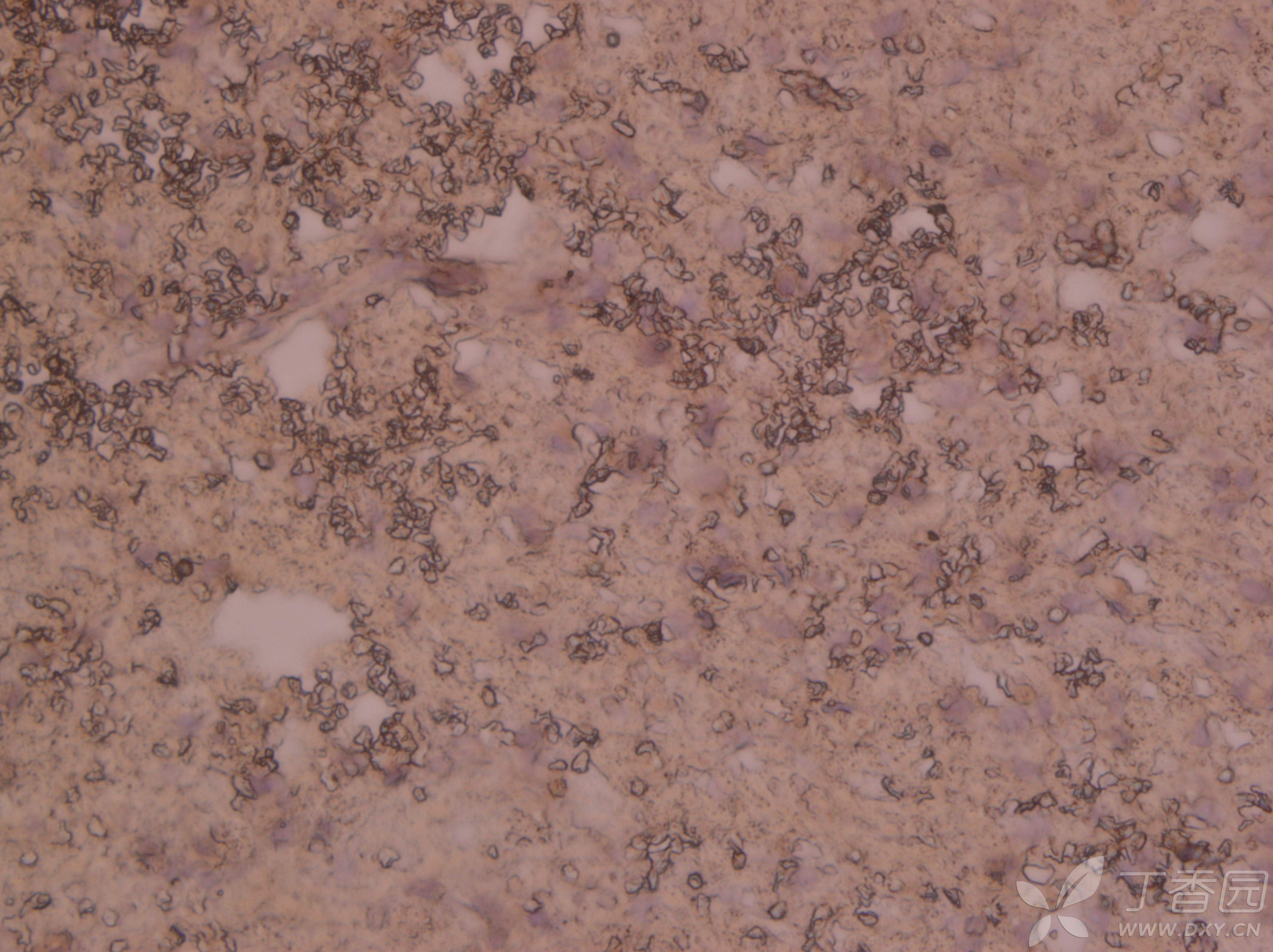 冰冻切片免疫组化效果不好 - 丁香园论坛