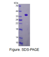 沉默调节蛋白4(SIRT4)活性蛋白