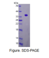 沉默调节蛋白4(SIRT4)活性蛋白